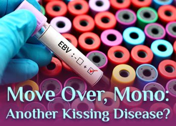 Waukee dentists at Lush Family Dental talk about a kissing disease you might be less familiar with than mononucleosis.