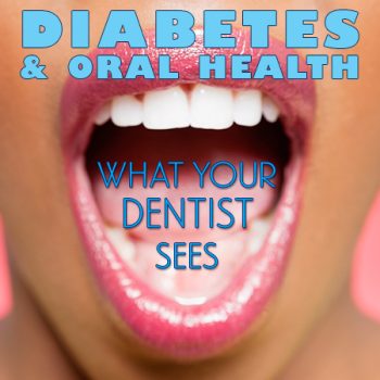 Waukee dentists at Lush Family Dental discuss the side effects of diabetes and how it can affect your oral health.