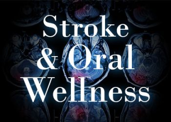 Waukee dentists at Lush Family Dental explain the connection between oral wellness and stroke, and how you can increase your protection.