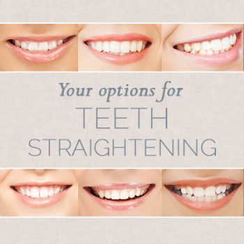 Waukee dentists, Drs. Louscher at Lush Family Dental share all you need to know about choosing the right teeth straightening option for you