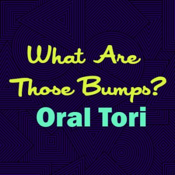 Waukee dentists, Drs. Louscher at Lush Family Dental explains oral tori—what they are, why they happen, and whether they are a cause for concern.