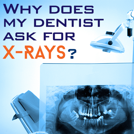 Waukee dentists, Drs. Michael & Blake Louscher at Lush Family Dental, discuss the importance of dental x-rays for accurate diagnosis and treatment planning.